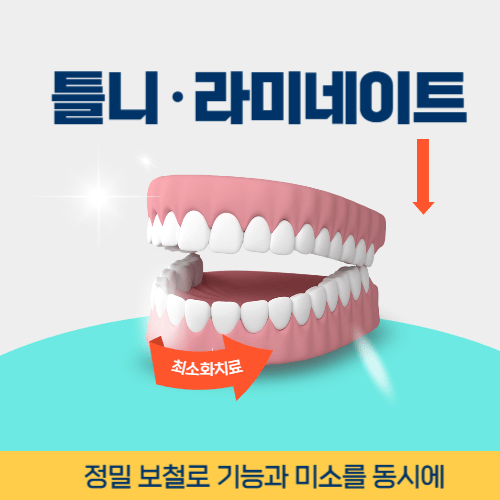 서울치과 서울특별시 치과 틀니 라미네이트