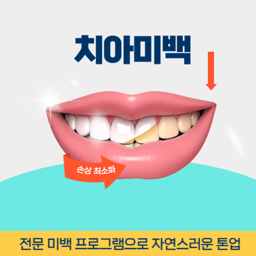 서울치과 서울특별시 치과 치아미백
