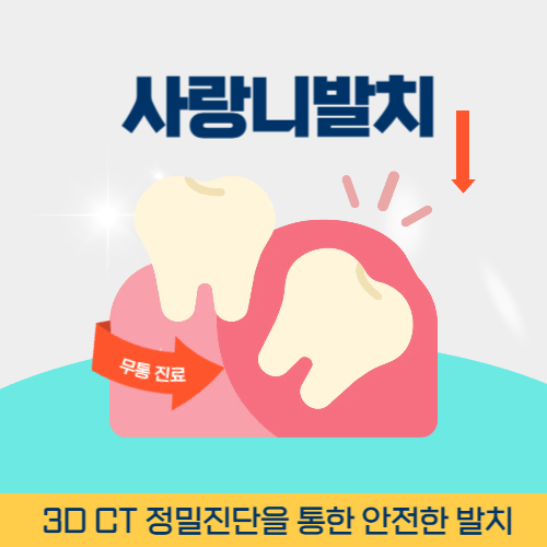 서울치과 서울특별시 치과 사랑니 발치